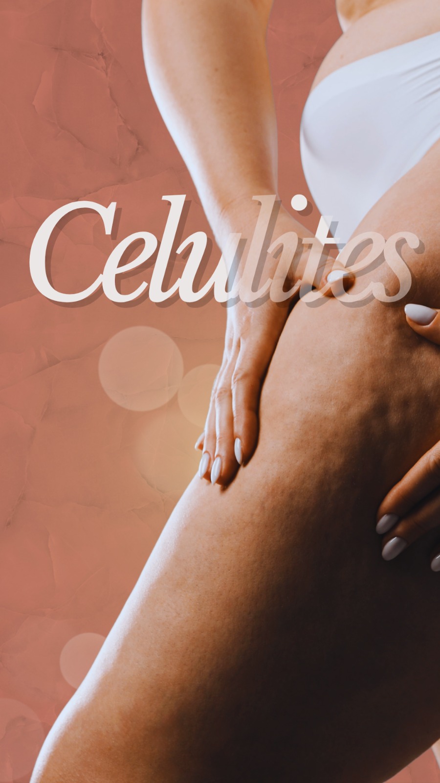 Tratamento para celulite - Clínica Elevar