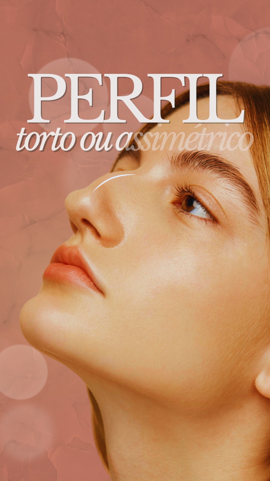 Tratamento para perfil assimétrico - Clínica Elevar
