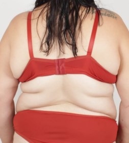 Antes do tratamento para firmeza abdominal - Clínica Elevar